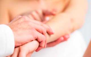 5 возможных последствий, если оторвать папиллому, или она сама оторвётся