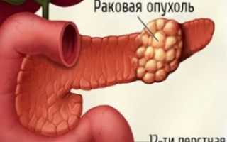 Симптомы и лечение паренхиматозного панкреатита