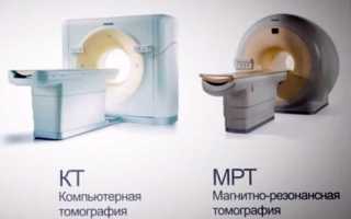 Как проводится МРТ пазух носа и что показывает