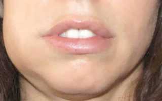 Как быстро избавиться от флюса дома