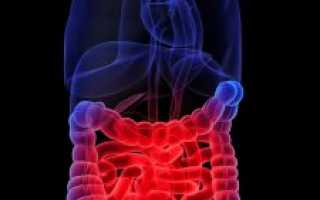 Заболевания толстой кишки