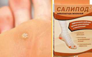 Как применять пластырь Салипод для лечения бородавок на ногах