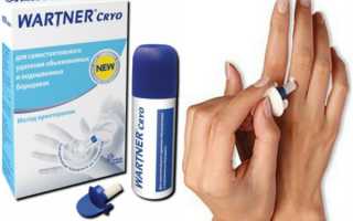 Криофарма для прижигания бородавок на основе азота, преимущества метода