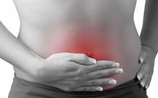 Дефект кишечника