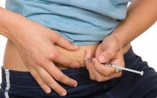 Препарат Оргалутран при подготовке к ЭКО: как применять для успешного результата