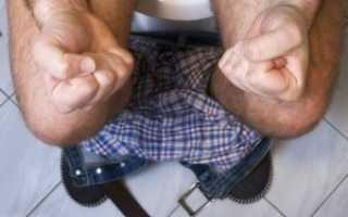 Болезни прямой кишки