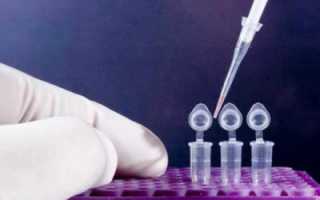 На каком участке тела бородавки самые опасные и каких лечить?