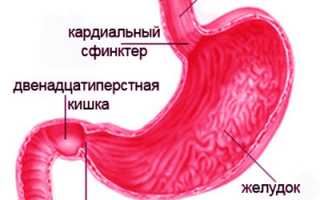 Симптомы и лечение стеноза 12-перстной кишки