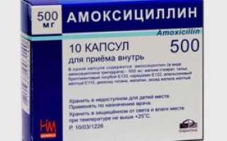 На гландах появились белые комочки что это означает