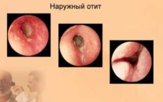 Боль за ухом справа причины, возможные заболевания, способы лечения, профилактика