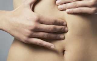 Свищи в кишечнике