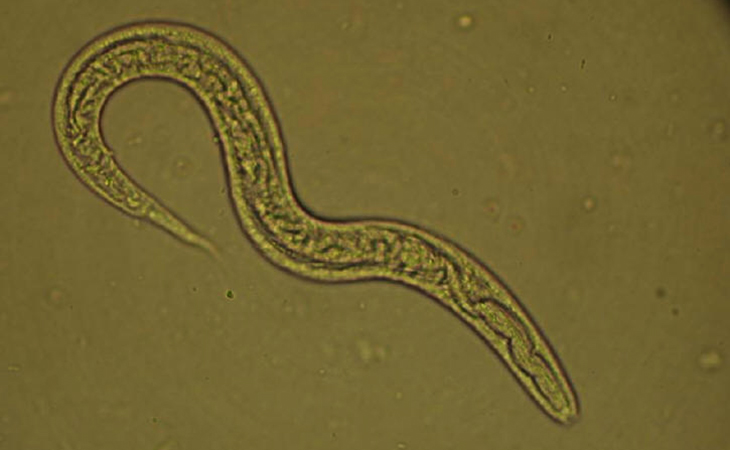 Strongyloides stercoralis