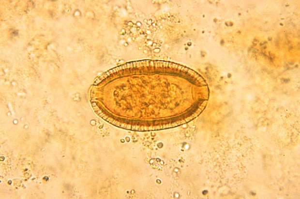 Capillaria hepatica