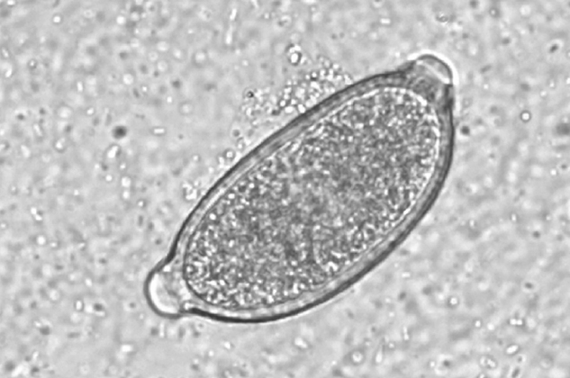 Capillaria aerophila