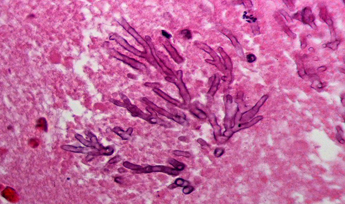 Аspergillus