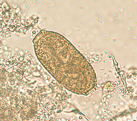 Capillaria philippinensis