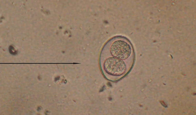 Isospora Felis