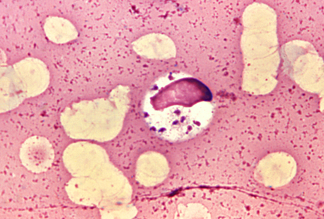Leishmania