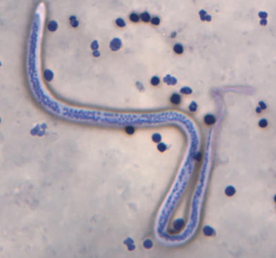 Wuchereria bancrofti
