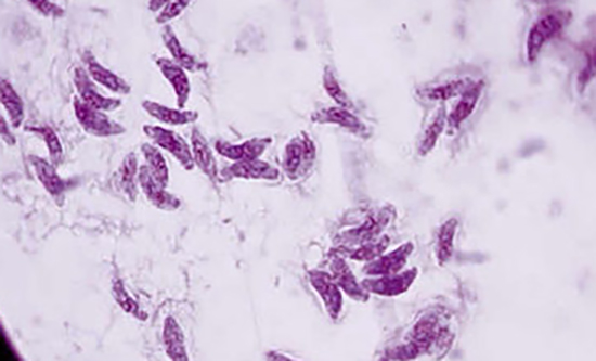 Toxoplasma gondii