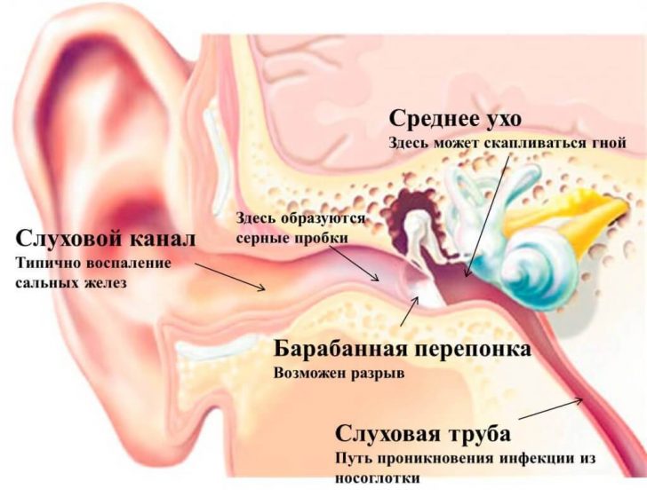 Особенности повреждения барабанной перепонки