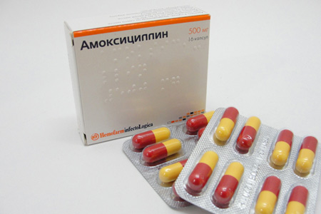 Почему появляются белые прыщи на задней стенке горла