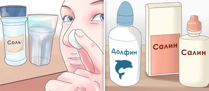 Гайморит симптомы и лечение у взрослых без пункции на дому