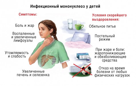 Признаки проявления инфекционного мононуклеоза