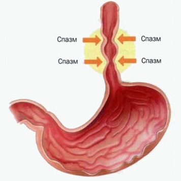 Комок в груди что это может быть