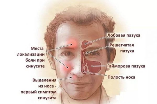 Гормональные капли в нос