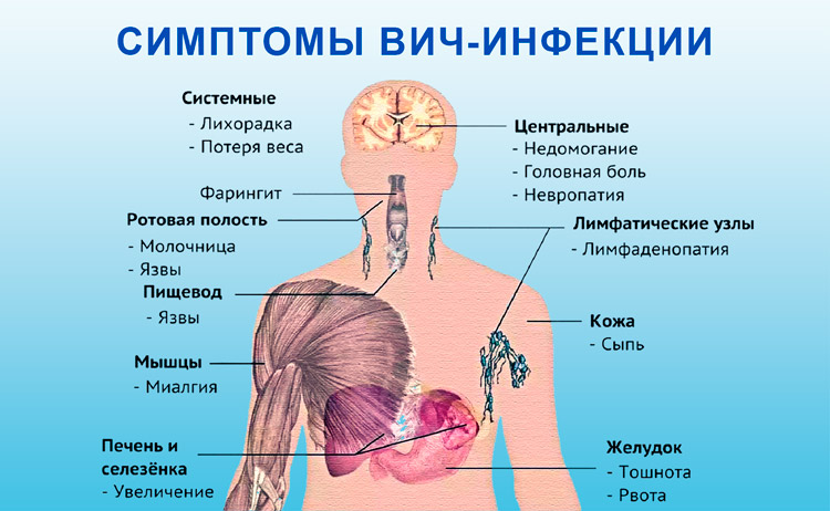 Симптомы и лечение грибковых заболеваний в горле