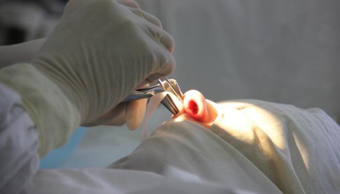 Гайморотомия