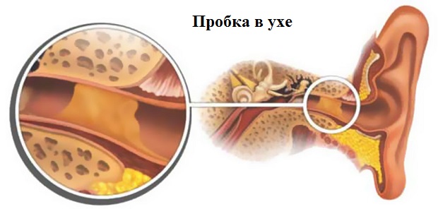 Продувание ушей в домашних условиях