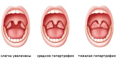 Полное описание препарата Эуфорбиум композитум