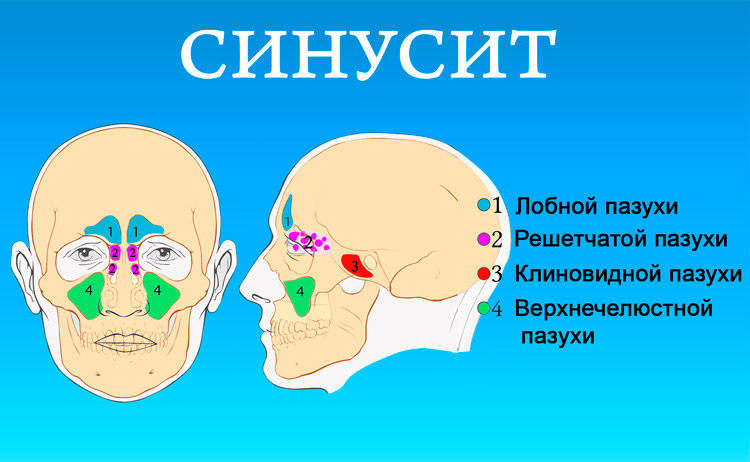 Сопли с кровью у взрослых и детей