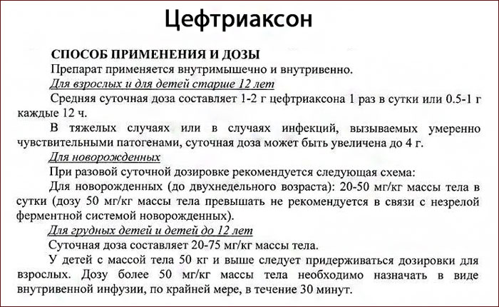 Является ли остеохондроз причиной отеков шейных позвонков