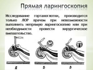Что показывает УЗИ сканирование горла и гортани