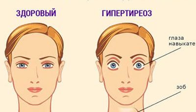 Причины болей кадыка при глотании
