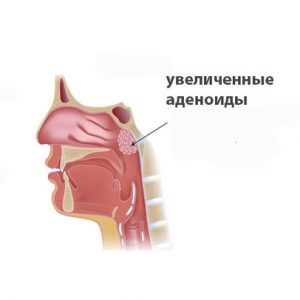 Лимфомиозот инструкция по применению