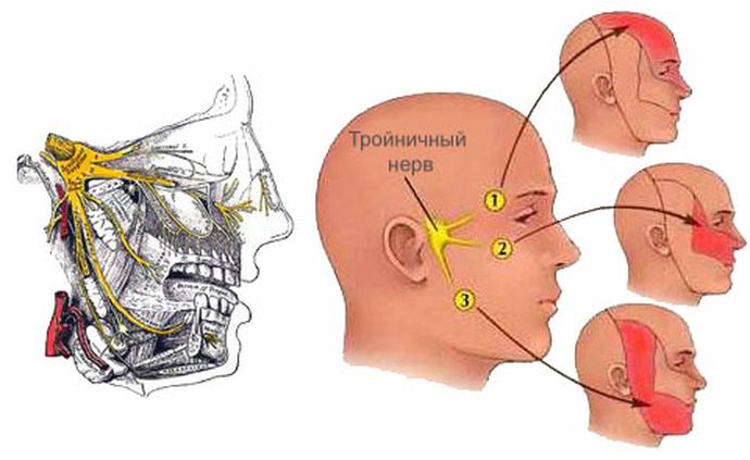 Тройничный нерв Тройничный нерв и зоны иннервации