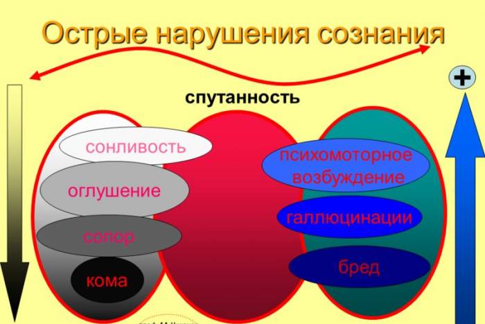 Нарушения сознания Острые нарушения сознания