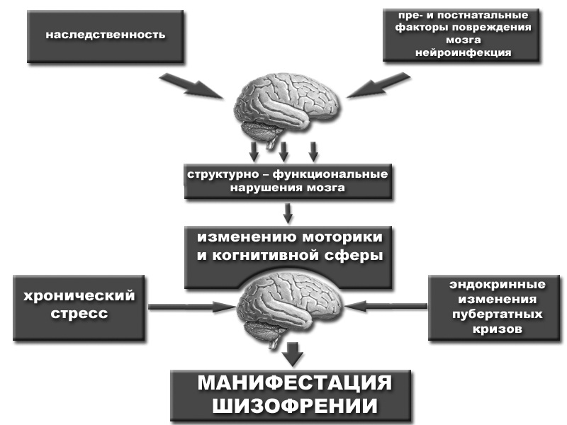 Шизофрения. Схема Схема возможных причин развития шизофрении