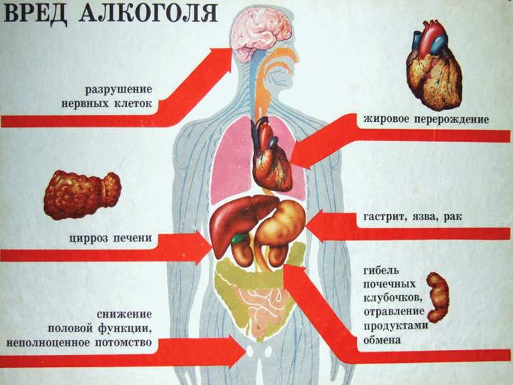 Вред алкоголя Негативное влияние алкоголя на организм человека